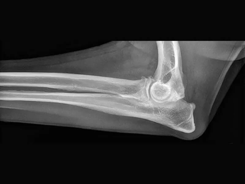 Image of pet elbow disease