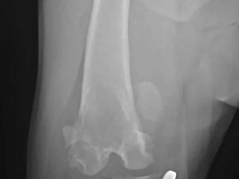 Medial Patella Luxation xray