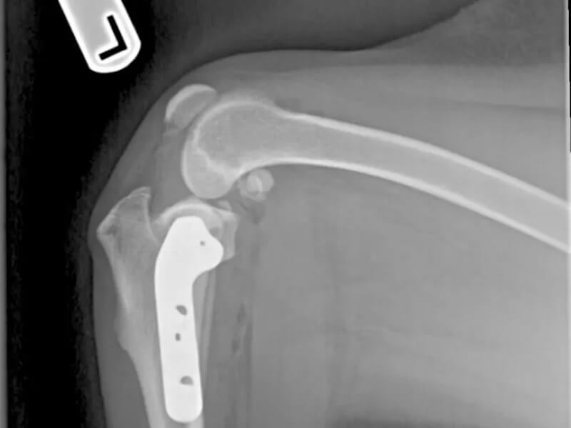 TPLO xray